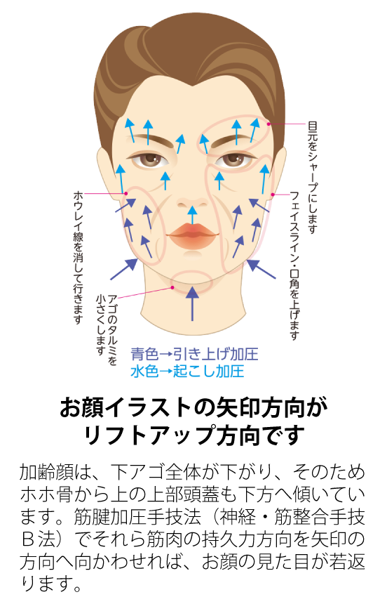 お顔イラストの矢印方向がリフトアップ方向です:加齢顔は、下アゴ全体が下がり、そのためホホ骨から上の上部頭蓋も下方へ傾いています。筋腱加圧手技法（神経・筋整合手技Ｂ法）でそれら筋肉の持久力方向を矢印の方向へ向かわせれば、お顔の見た目が若返ります。