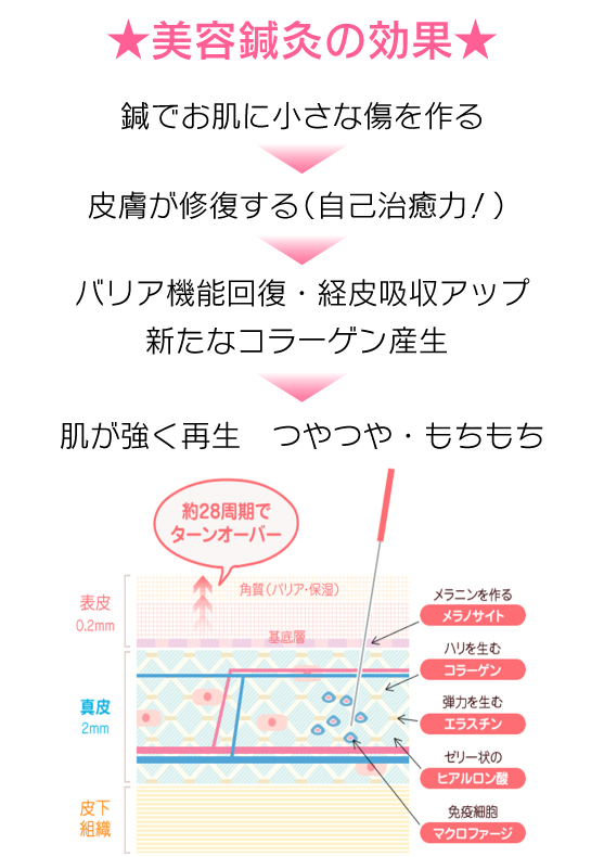 ★美容鍼灸の効果★鍼でお肌に小さな傷を作る→皮膚が修復する（自己治癒力！）→バリア機能回復経皮吸収アップ、新たなコラーゲン産生→肌が強く再生、つやつや・もちもち