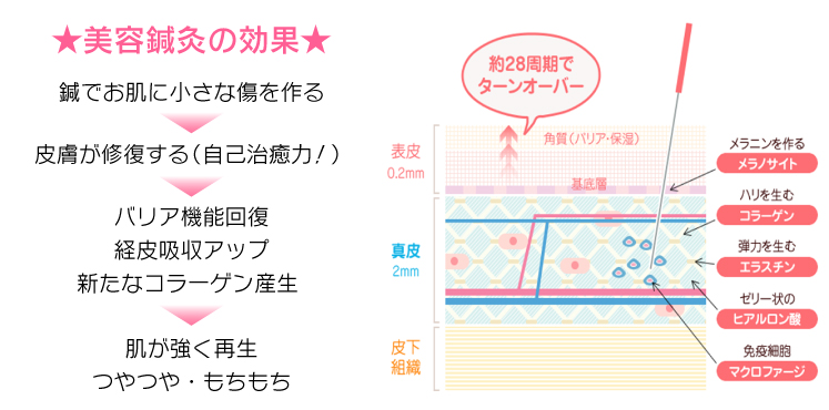 ★美容鍼灸の効果★鍼でお肌に小さな傷を作る→皮膚が修復する（自己治癒力！）→バリア機能回復経皮吸収アップ、新たなコラーゲン産生→肌が強く再生、つやつや・もちもち